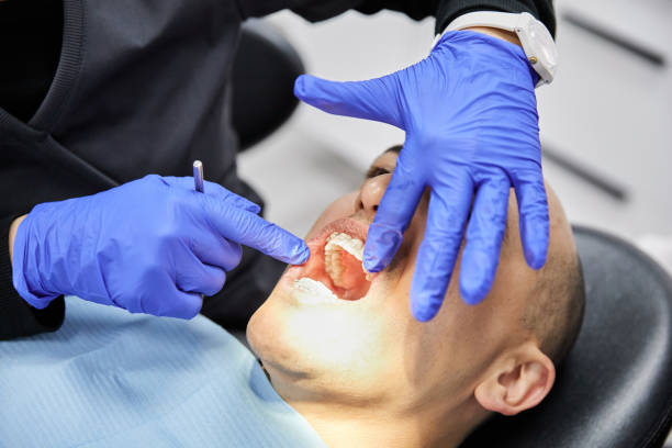 Best After-Hours Emergency Dentist in Mitchellville, MD